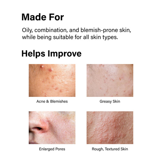 Anti-Acne Salicylic Acid 2% Face Wash For Oily & Acne Prone Skin
