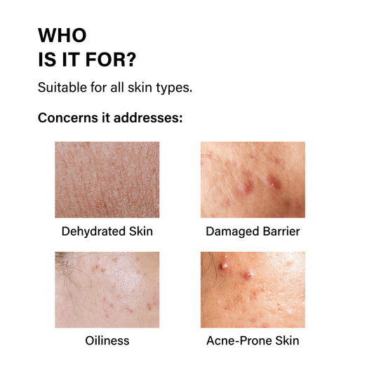 Vitamin B5 10% Oil-Free Moisturizer