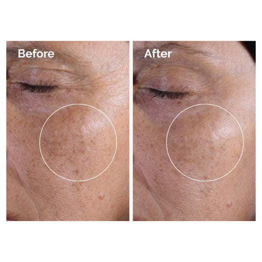 GLYCOLIC ACID EXFOLIATING TONER