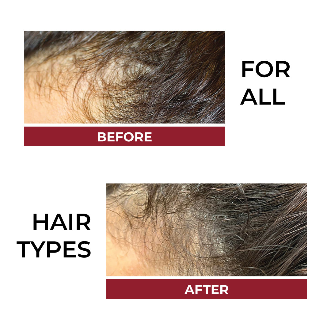 HAIR FALL CONTROL CONDITIONER