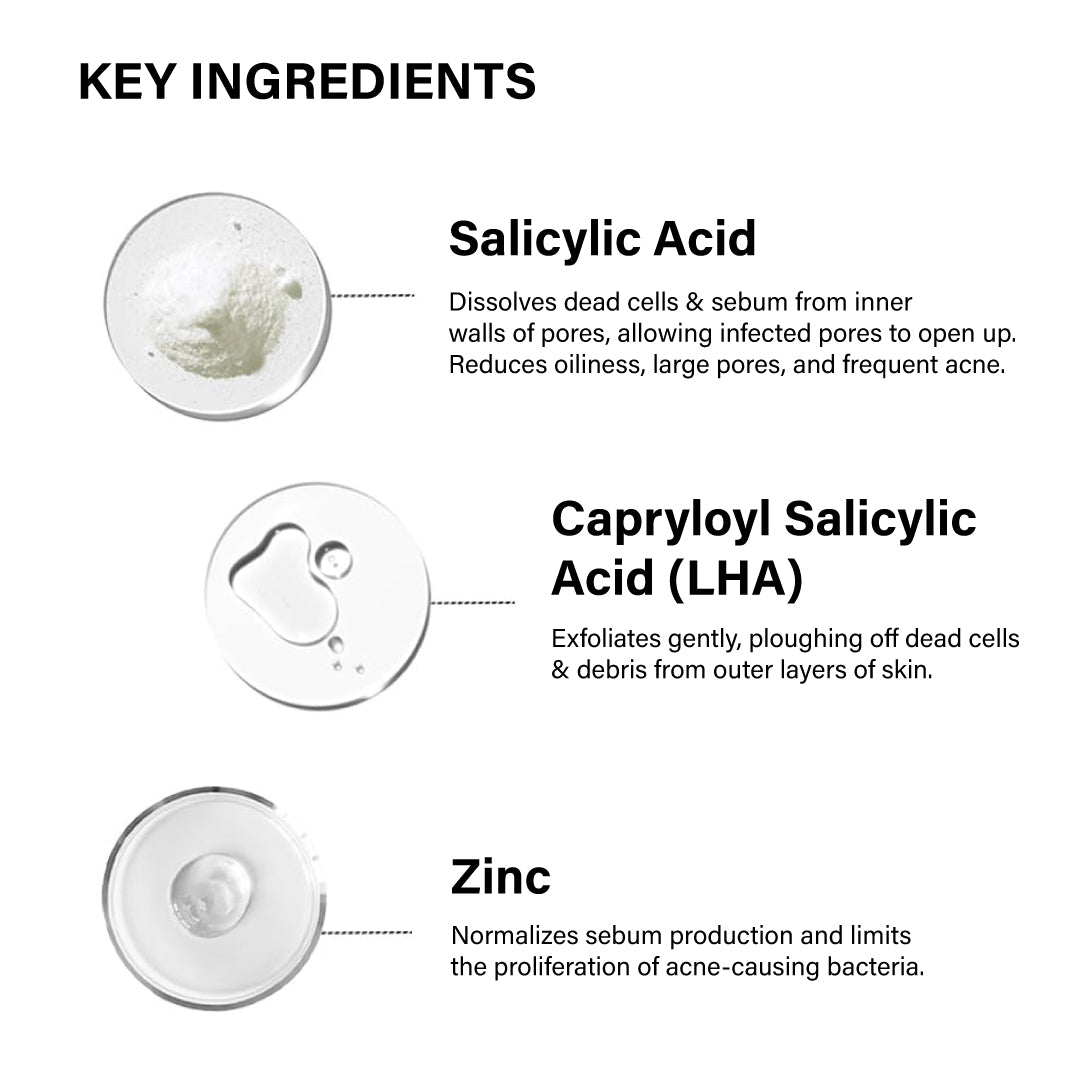 Anti-Acne Salicylic Acid 2% Face Wash For Oily & Acne Prone Skin