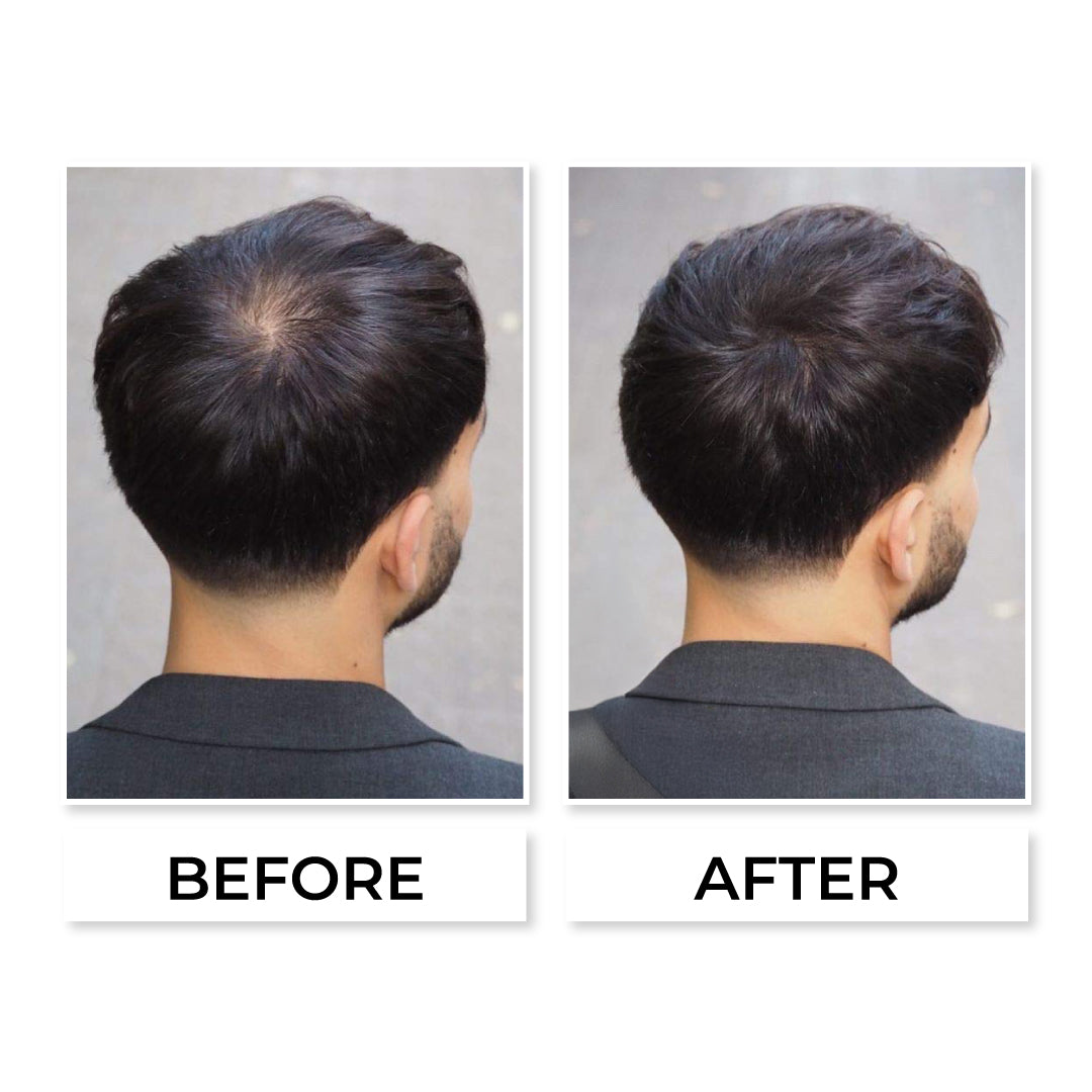Hair Fiber